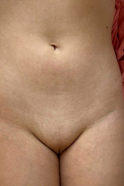 Azuki Sun More Nude Selfies Zishy